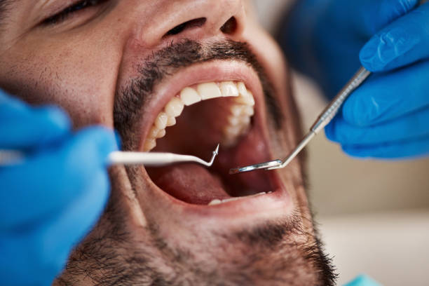Best Weekend Emergency Dentist in Lyons, KS